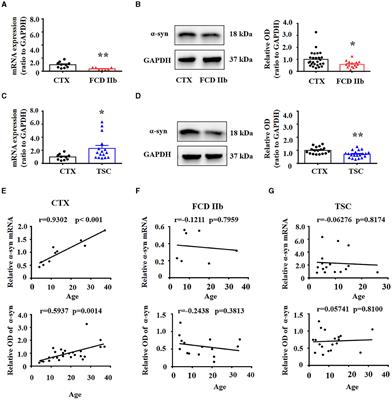 Expression profiles of α-synuclein in cortical lesions of patients with FCD IIb and TSC, and FCD rats